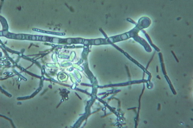 fungal hyphae1